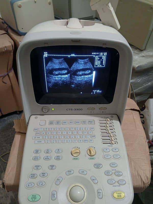 portable Ultrasound machines (fresh imported stock) 5