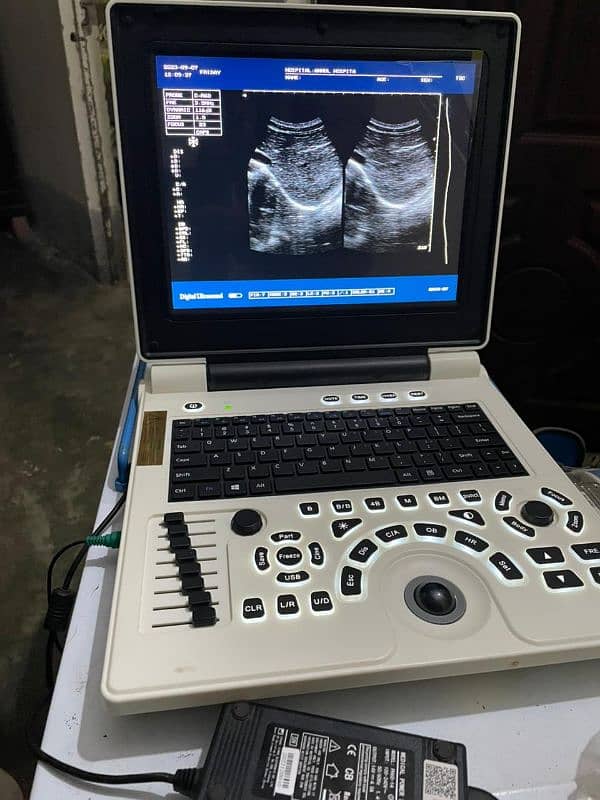 portable Ultrasound machines (fresh imported stock) 6