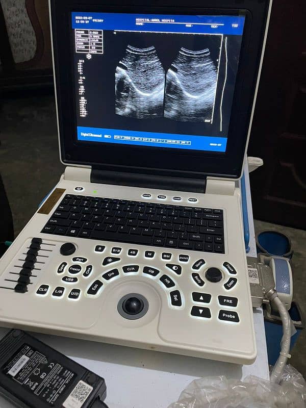 portable Ultrasound machines (fresh imported stock) 8