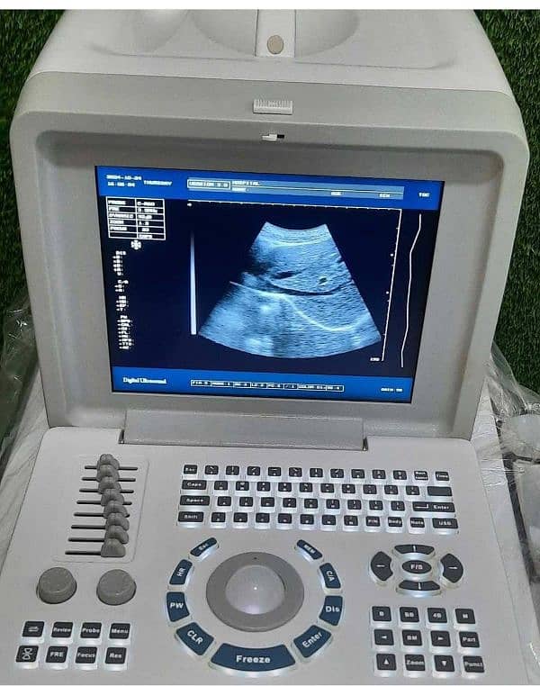 portable Ultrasound machines (fresh imported stock) 9