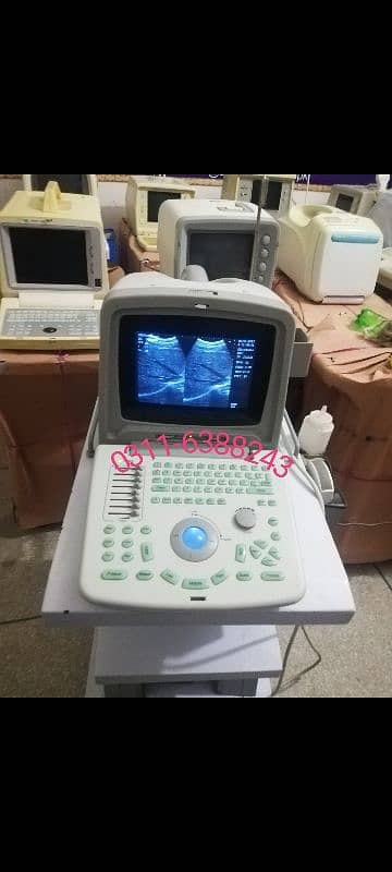 ultrasound machine's 1