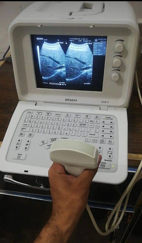 ultrasound machine's 2