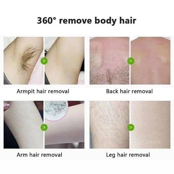 pailnless hair Removal hair Removal dream 2