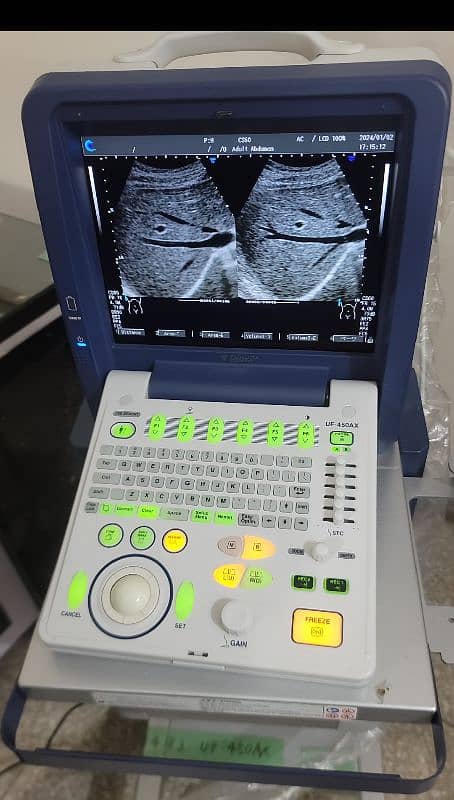 china & Japanese Ultrasound machine's 9