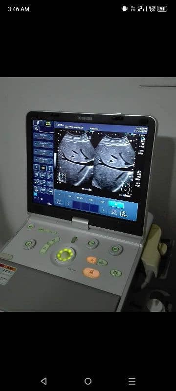 china & Japanese Ultrasound machine's 14