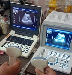 Ultrasound machine's