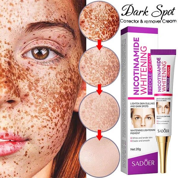 Nicotinamide Whitening Freckles Cream Remove Melasma Dark Spot Acne 0