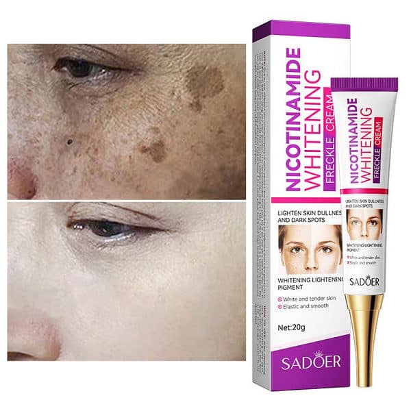 Nicotinamide Whitening Freckles Cream Remove Melasma Dark Spot Acne 5