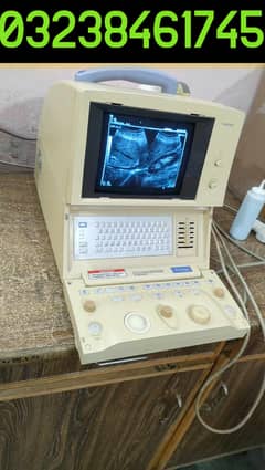 Toshiba justvision 200 portable japanese ultrasound machine