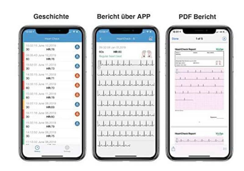 viatom check me plus ecg monitor recorder app control person ekg 4