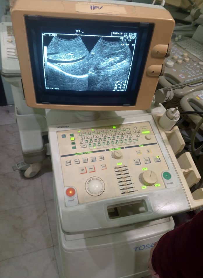 Ultrasound Machine for sale 1