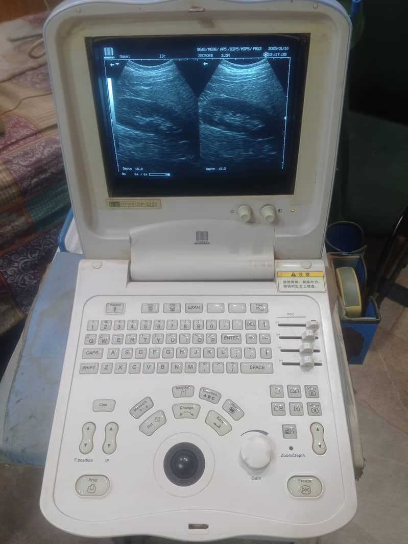 Ultrasound Machine for sale 4