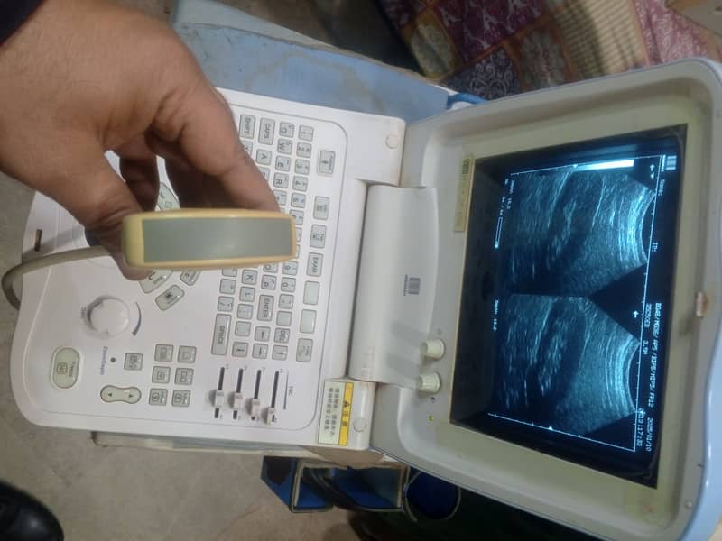 Ultrasound Machine for sale 5