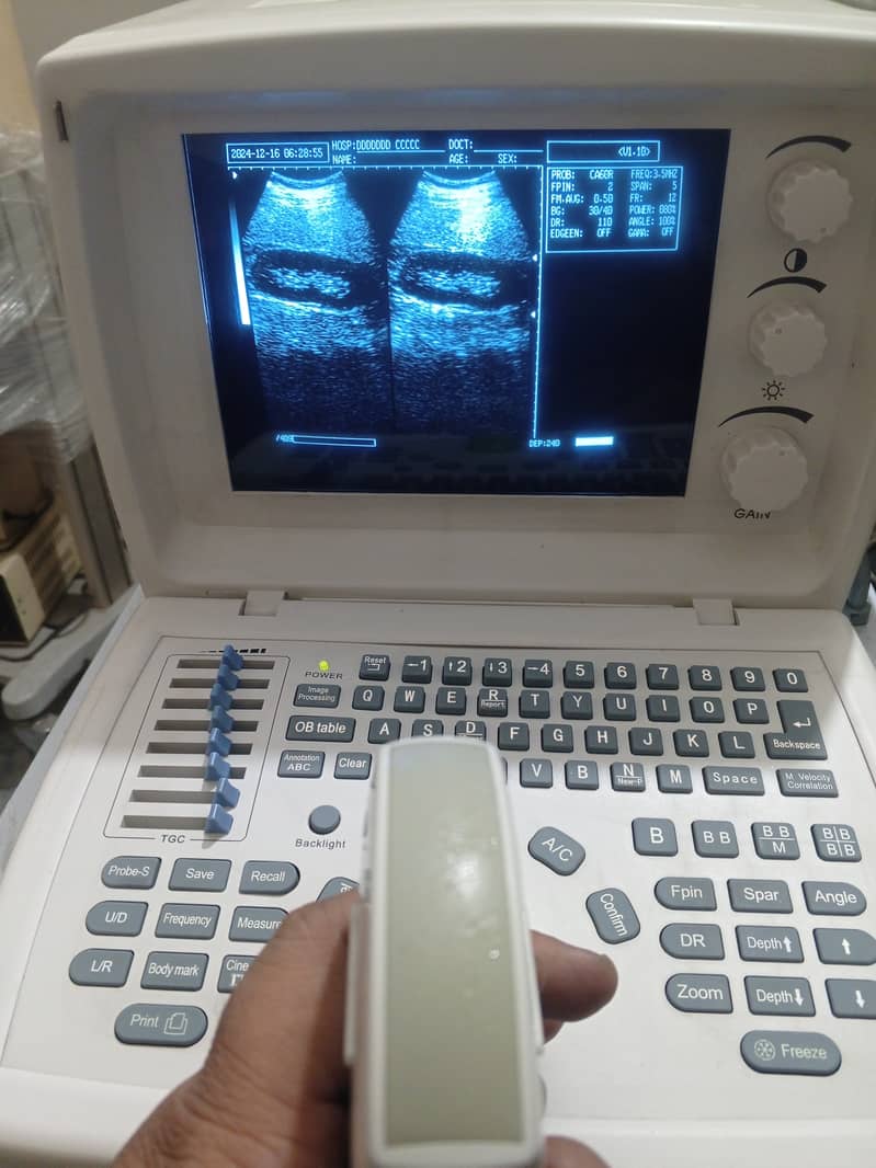 Ultrasound Machine for sale 11