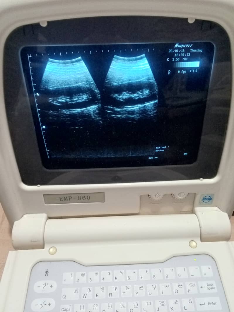 Ultrasound Machine for sale 12