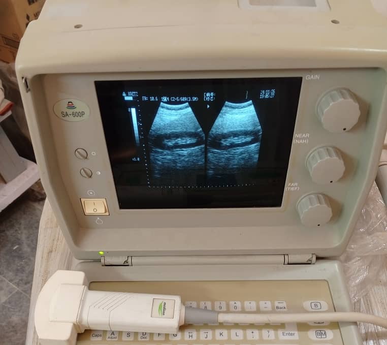 Ultrasound Machine for sale 17