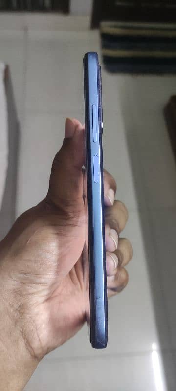 Xiaomi Redmi Note 11 3