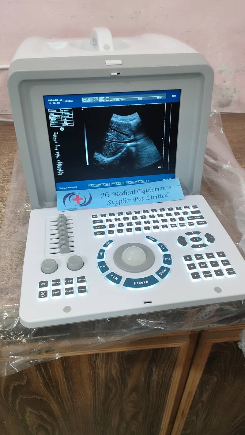 Brand new & used Ultrasound machine Chinese (with or without battery) 0