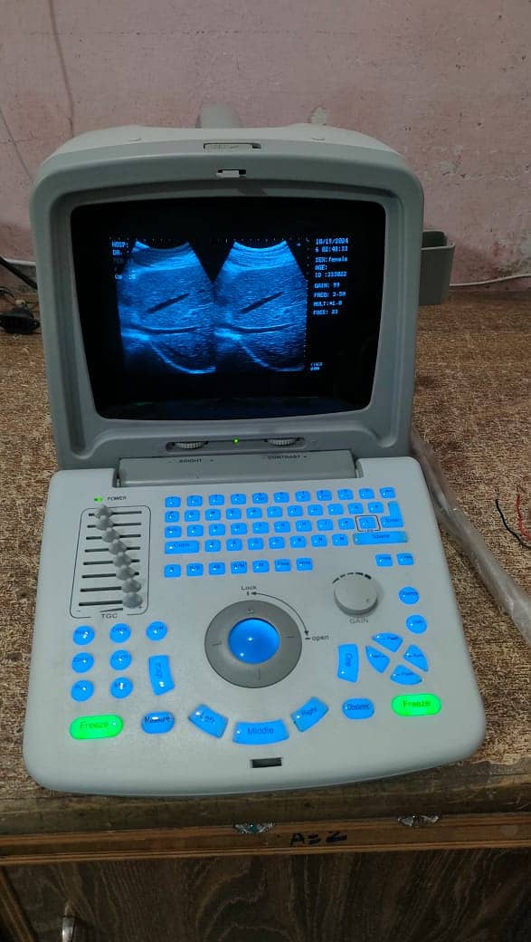 Brand New & USED Chinese Ultrasound Machine (with or without BATTERY 2