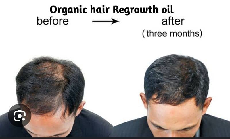 Hair Regrowth organic oil , Anti Hair fall, Anti Dendruf oil . 60 ml 3