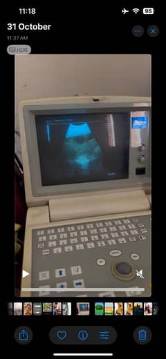 ultrasound machine