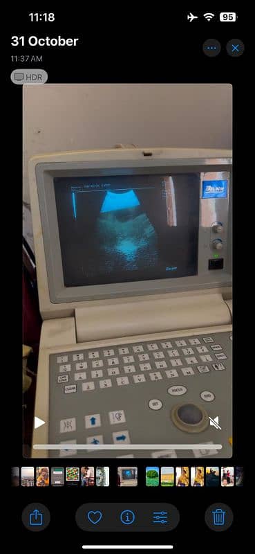 ultrasound machine 0