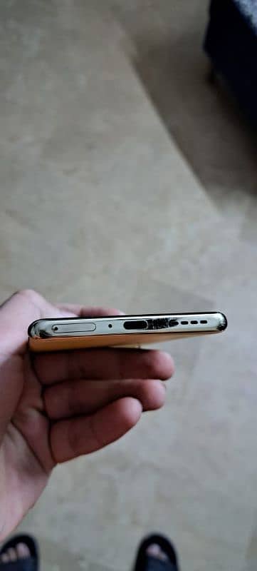 infinix note 40 pro zabardast condition 6