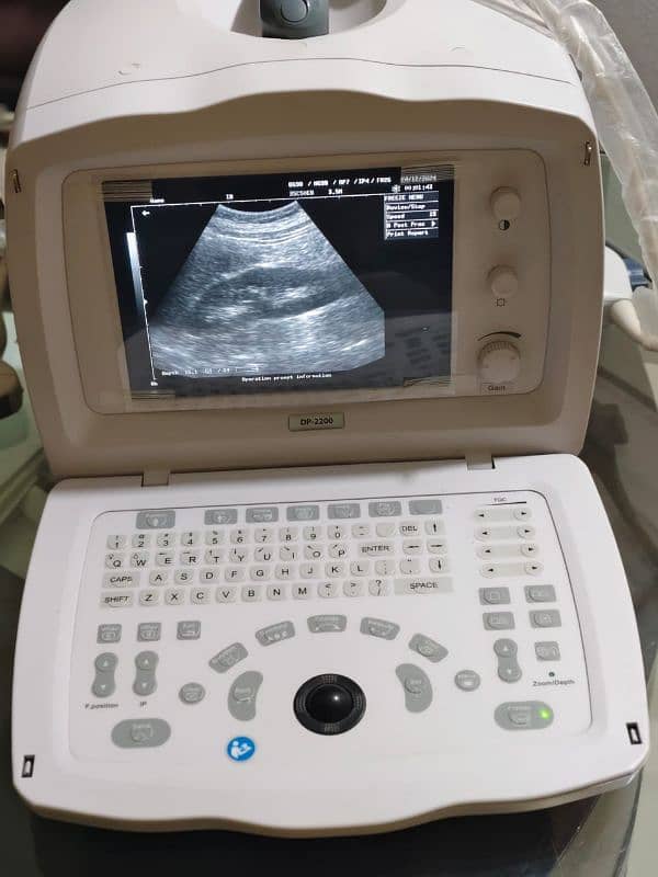 Mindray ultra sound dp 2200 ECG Patient moniter Vital sign monite 0