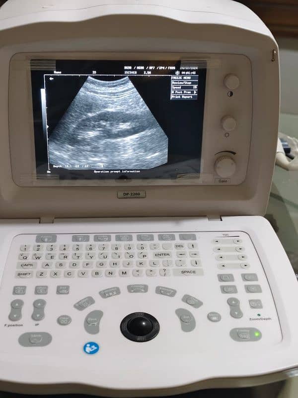 Mindray ultra sound dp 2200 ECG Patient moniter Vital sign monite 8