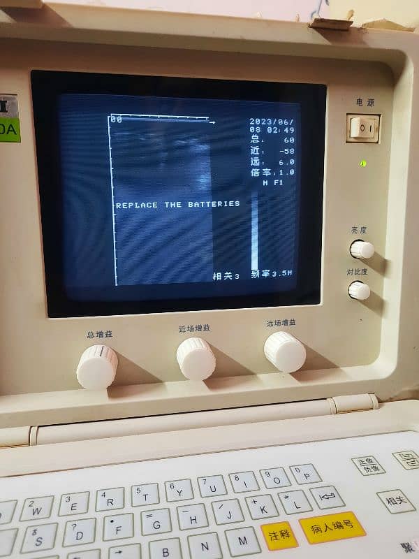 Ultrasound  machine CTS-50A 0