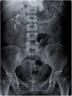 X Ray