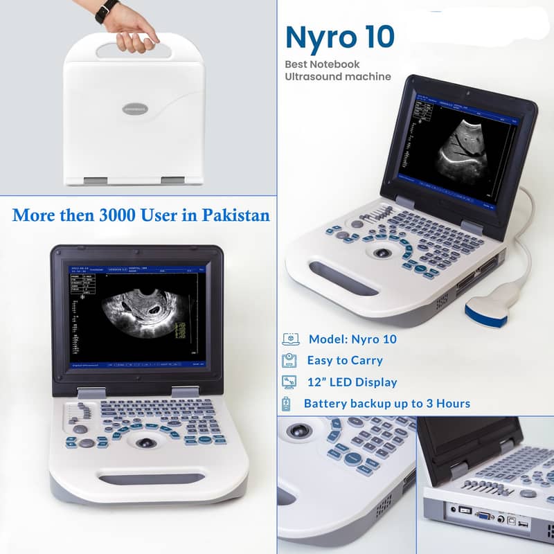 Nyro10 Humen / Vet Ultrasound Machine in Best Price in Pakistan 3