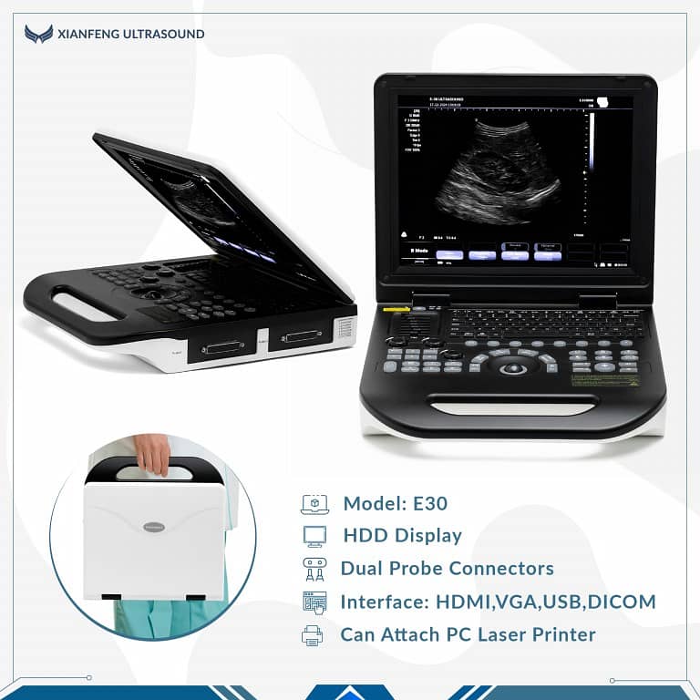 E30 new Color Doppler in amzing best price Pakistan 1