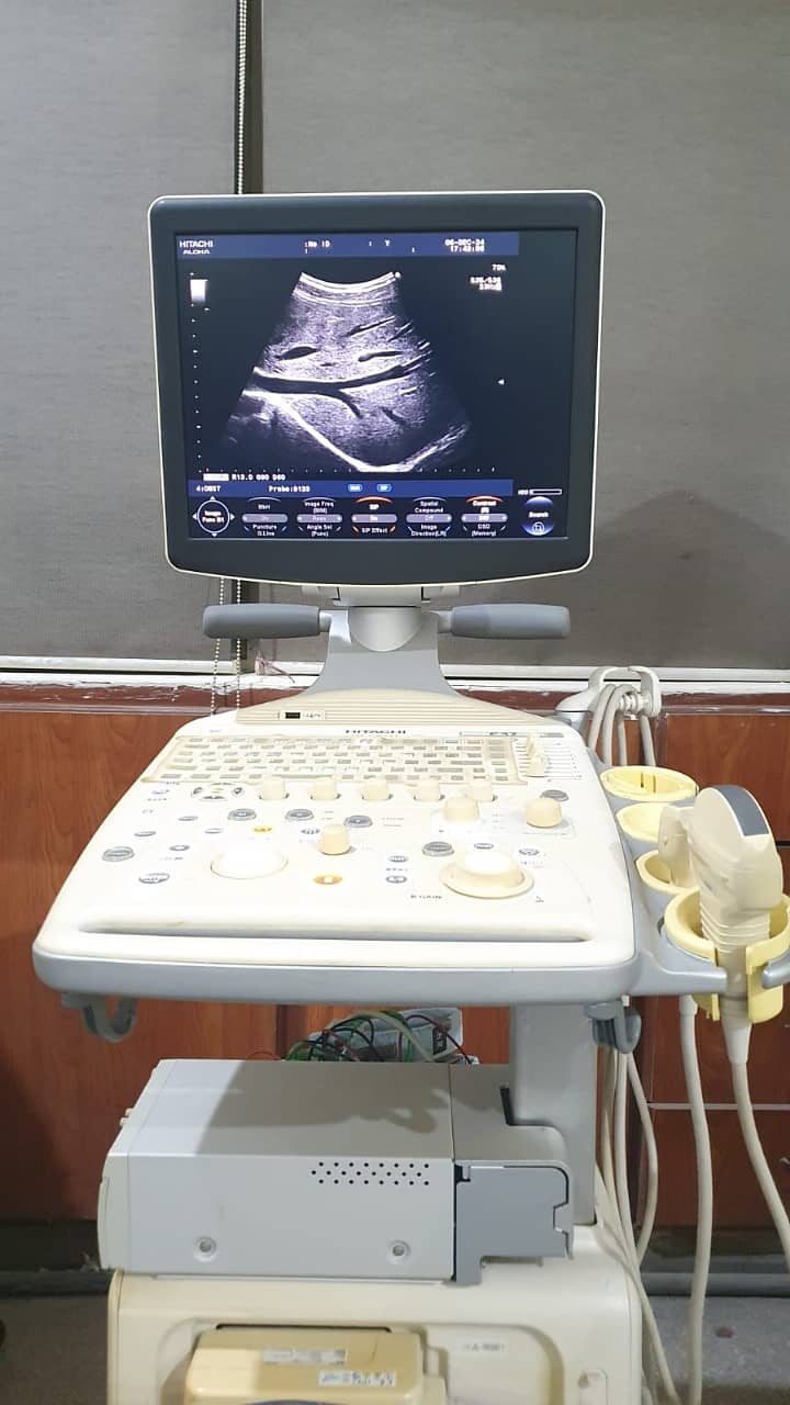 ultrasound machines/Brand New ultrasound machine / ultrasound machine 0