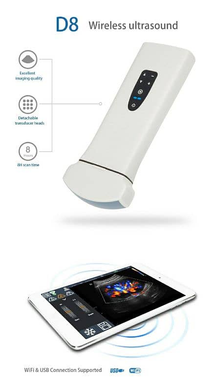 new wireless and USB Ultrasound probes can attach Mobile Tablet 6