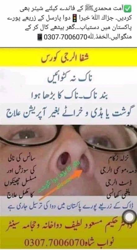 ناک نہ کٹواٸیں 0