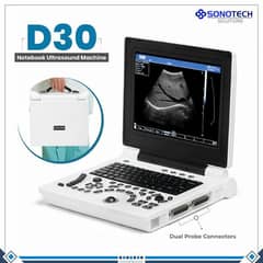 Brand new D30 ultrasound machine Japnese standard amazing best price