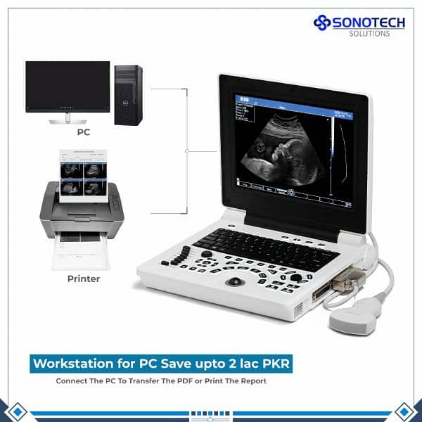 Brand new D30 ultrasound machine Japnese standard amazing best price 4