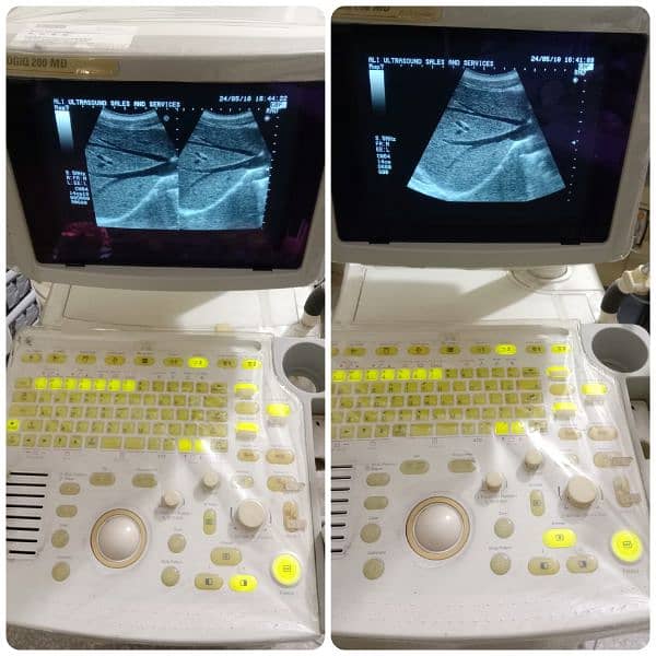 ALL TYPES OF ULTRASOUND MACHINES AVAILABLE FOR SALE 9