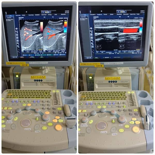 ALL TYPES OF ULTRASOUND MACHINES AVAILABLE FOR SALE 10