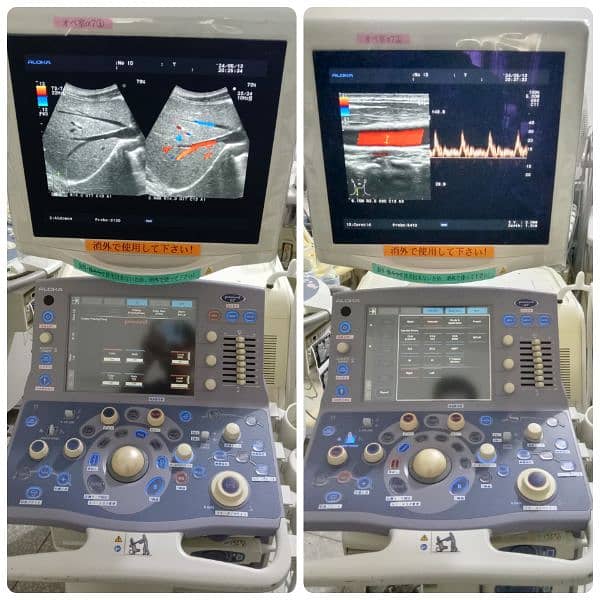 ALL TYPES OF ULTRASOUND MACHINES AVAILABLE FOR SALE 11