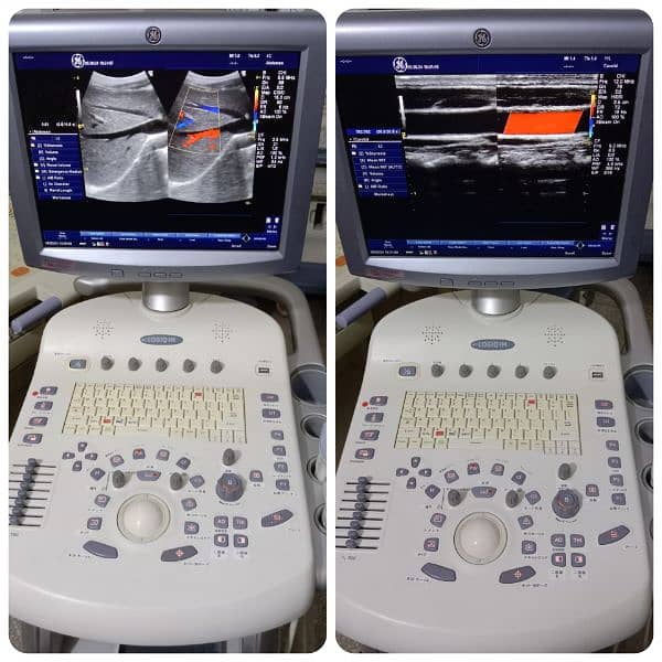 ALL TYPES OF ULTRASOUND MACHINES AVAILABLE FOR SALE 13