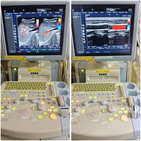 ALL TYPES OF ULTRASOUND MACHINES AVAILABLE FOR SALE 14