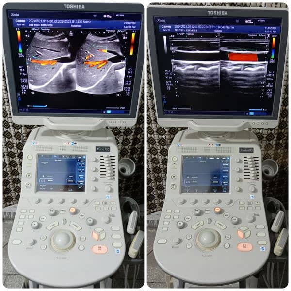 ALL TYPES OF ULTRASOUND MACHINES AVAILABLE FOR SALE 15