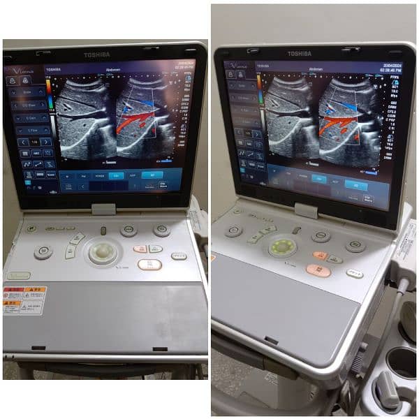 ALL TYPES OF ULTRASOUND MACHINES AVAILABLE FOR SALE 19