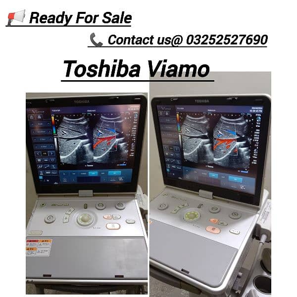 ALL TYPES OF ULTRASOUND MACHINES AVAILABLE FOR SALE 3