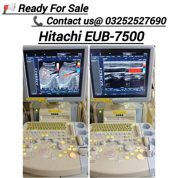 ALL TYPES OF ULTRASOUND MACHINES AVAILABLE FOR SALE 6