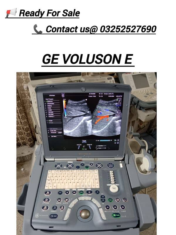 ALL TYPES OF ULTRASOUND MACHINES AVAILABLE FOR SALE 11