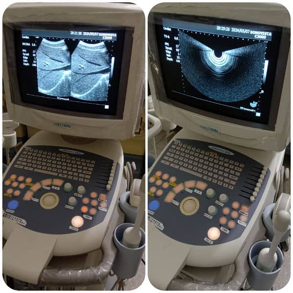 ALL TYPES OF ULTRASOUND MACHINES AVAILABLE FOR SALE 14