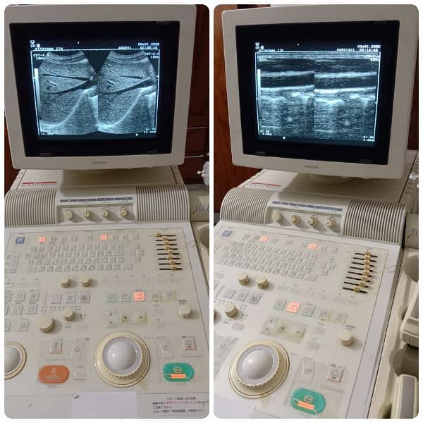 ALL TYPES OF ULTRASOUND MACHINES AVAILABLE FOR SALE 15